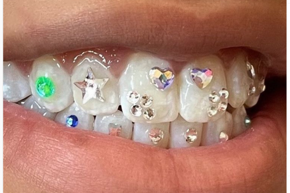 Biżuteria na zębach (fot. Instagram)