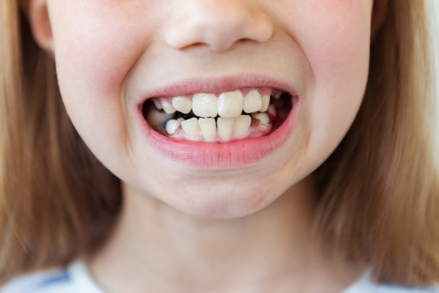 Jak leczenie ortodontyczne, to tylko z własnej kieszeni?