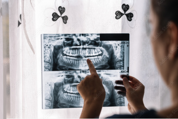 Pacjent ortodontyczny z nieswoistymi dolegliwościami (fot. Adobe) Krzywy zgryz to problem poważniejszy niż estetyczny