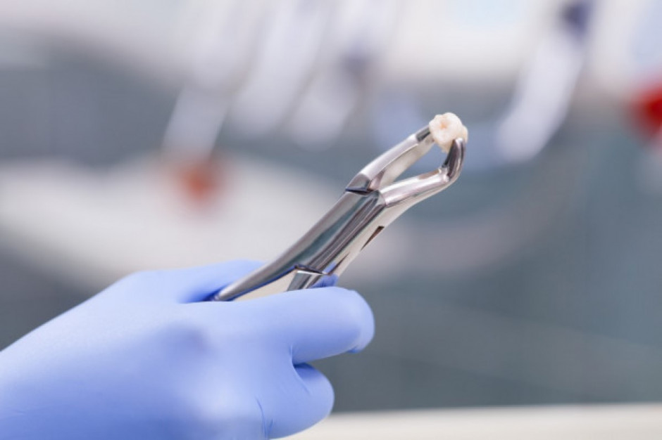 Wirusowe zapalenie mózgu jako powikłanie ekstrakcji zębów (fot. Shutterstock)