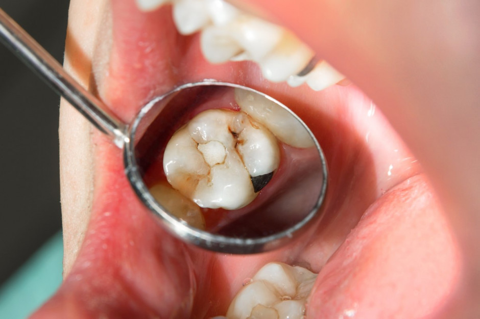 Skutki pandemii dla zdrowia jamy ustnej (fot. Adobe)