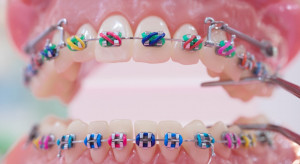 Osoby dorosłe coraz częściej wybierają leczenie ortodontyczne