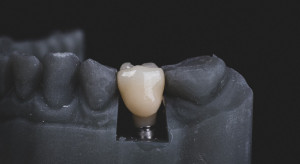 Alergia na penicylinę zwiększa ryzyko utraty implantu zębowego?