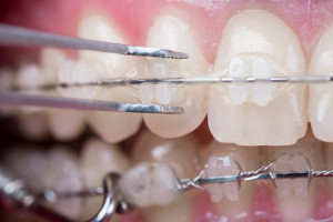 Ortodoncja: dentysta bez specjalizacji przestępcą?