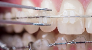 Ortodoncja: dentysta bez specjalizacji przestępcą?