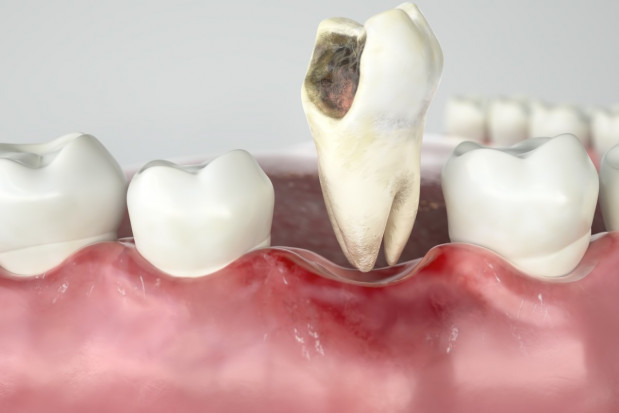 Szansa na zrobienie kariery naukowej na chirurgii stomatologicznej Fot. Shutterstock ŚUM: trzy stanowiska dla asystentów na stomatologii