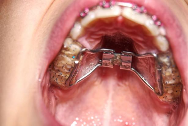 Ortodoncja dla każdego lekarza dentysty? Fot. AdobeStock Zdecydowany głos przeciwko uprawianiu ortodoncji bez specjalizacji