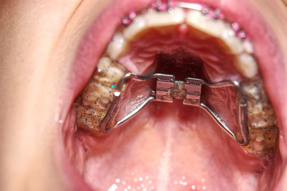 Ortodoncja dla każdego lekarza dentysty? Fot. AdobeStock