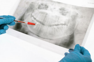 Szkolenie: obrazowanie 2D w stomatologii