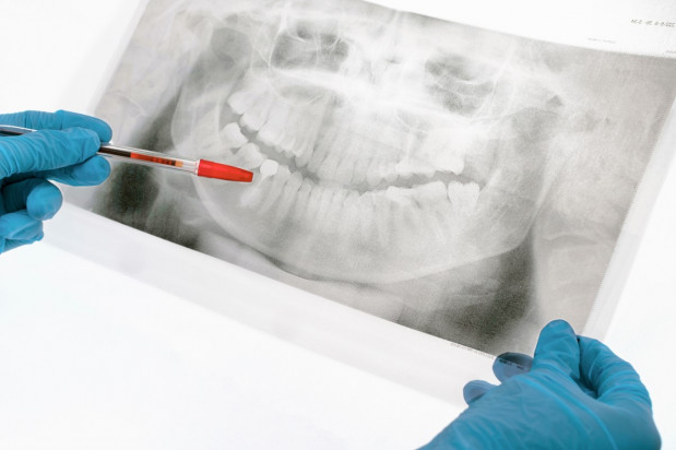 Szansa na nowe umiejętności z zakresu obrazowania 2D Fot. Shutterstock Szkolenie: obrazowanie 2D w stomatologii