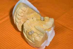 Zakład Karny szuka technika dentystycznego
