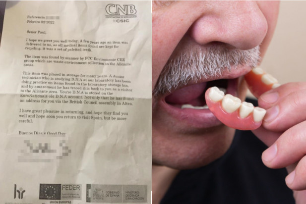 Proteza zębowa wróciła po 11 latach do właściciela