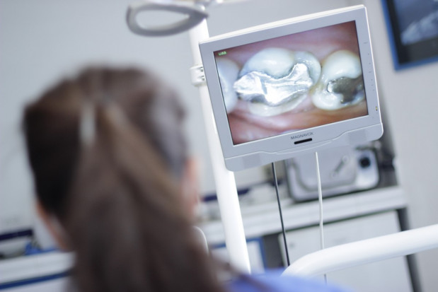 Amalgamat stomatologiczny na finiszu fot. AdobeSotck MZ decyduje: koniec amalgamatu stomatologicznego