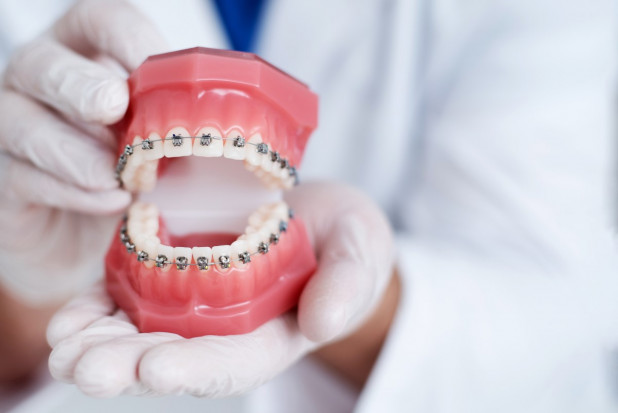 Kiedy dentysta może informować o udzielaniu świadczeń ortodontycznych