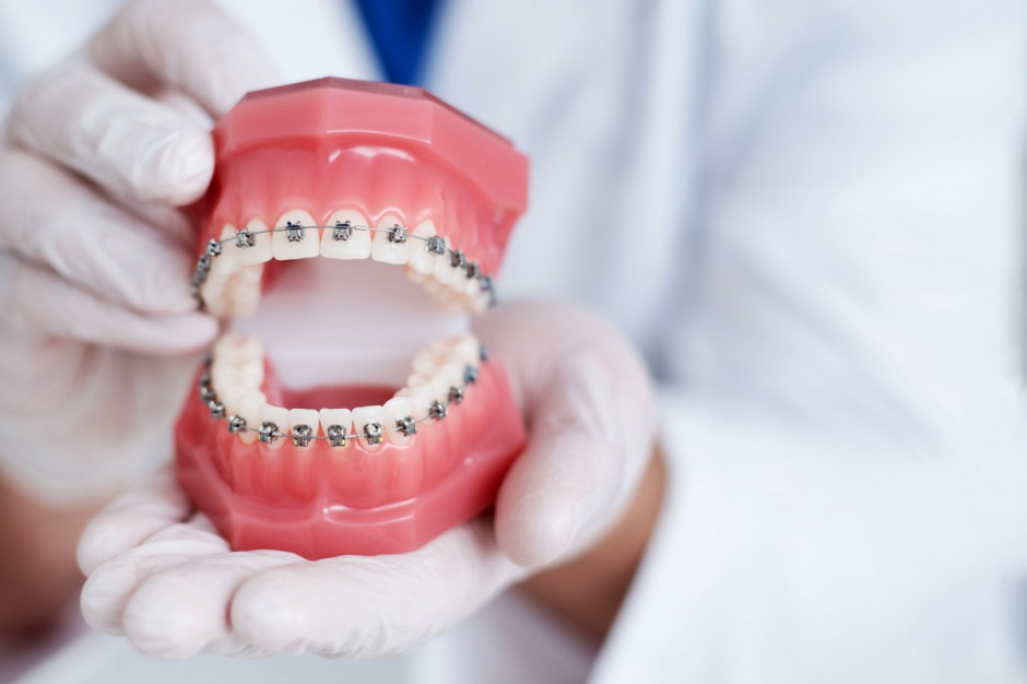 Leczenie ortodontyczne przez lekarza dentystę Fot. AdobeStock