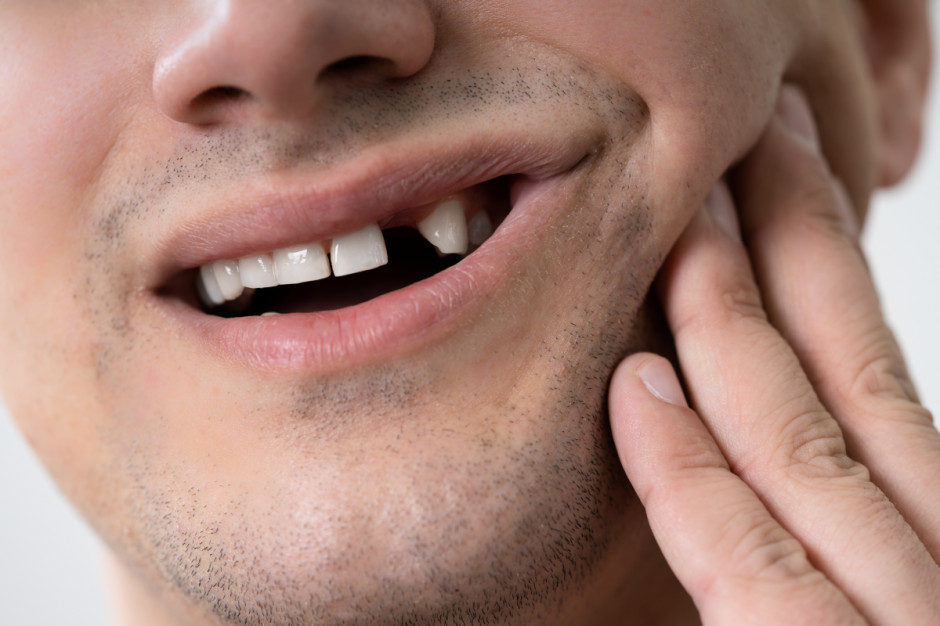 W dobie COVID-19 nawet co trzeci Polak rezygnuje z usług dentysty Fot. Shutterstock