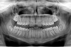 Stomatologia: kolejna szansa na kurs z obrazowania 2D