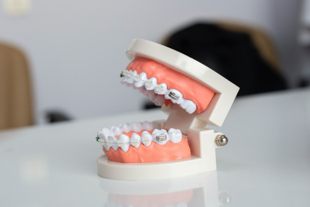 Ortodoncja: obalanie mitów
