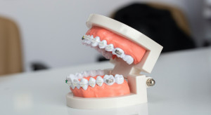 Ortodoncja: obalanie mitów