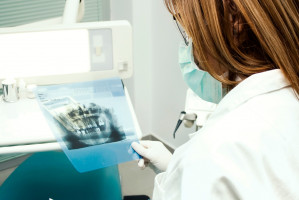 Zdjęcia RTG zębów. Jakie problemy rozwiązują