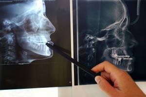 W GUMed praca dla asystenta w Zakładzie Ortodoncji Fot. Shutterstock Praca na stanowisku asystenta w GUMed. Termin składania ofert 18 sierpnia