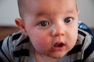 Ząbkowanie dzieci. Jakie objawy powinny niepokoić?