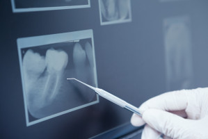 Doraźna opieka stomatologiczna w ofercie – jak wykazać
