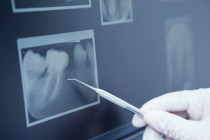 Dentysta a VAT od zakupu lampy do wybielania zębów