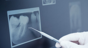 Duże komplikacje po wszczepieniu implantów, ale bez winy dentystki