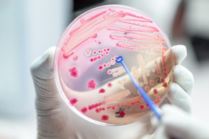 Nie tylko antybiotyki niszczą mikroflorę jamy ustnej. Jak zaradzić problemom?