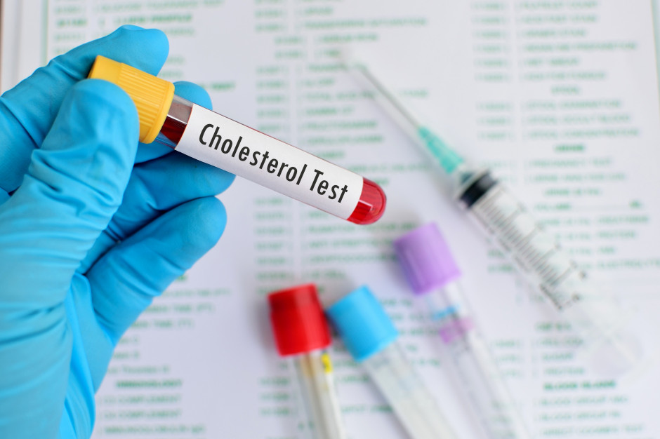 Wysoki poziom cholesterolu obniża powodzenie leczenia implantologicznego Fot. Shutterstock Wysoki poziom cholesterolu obniża powodzenie leczenia implantologicznego Fot. Shutterstock
