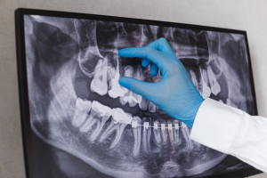 Kiedy należy się zasiłek celowy na leczenie kanałowe zęba. Opinia sądu