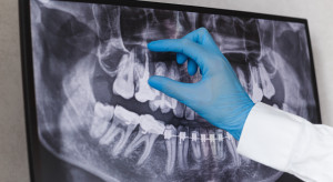 Kiedy należy się zasiłek celowy na leczenie kanałowe zęba. Opinia sądu