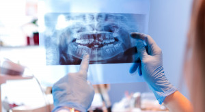 Poszukują dentystów pracujących na kontrakcie