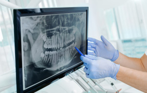 Aparat ortodontyczny. Leczenie do końca życia