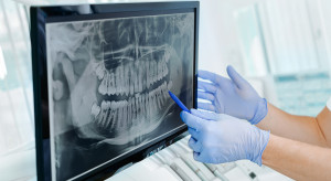 Aparat ortodontyczny. Leczenie do końca życia