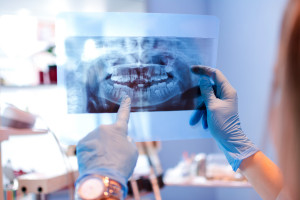 Kardynalne błędy w leczeniu ortodontycznym. Sąd przyznał pacjentce 105 tys. zł