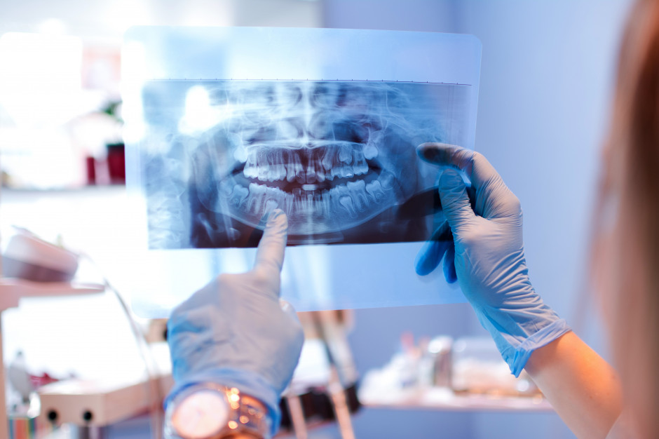 Poszkodowana pacjentka po kuriozalnym leczeniu ortodontycznym fot. AdobeStock