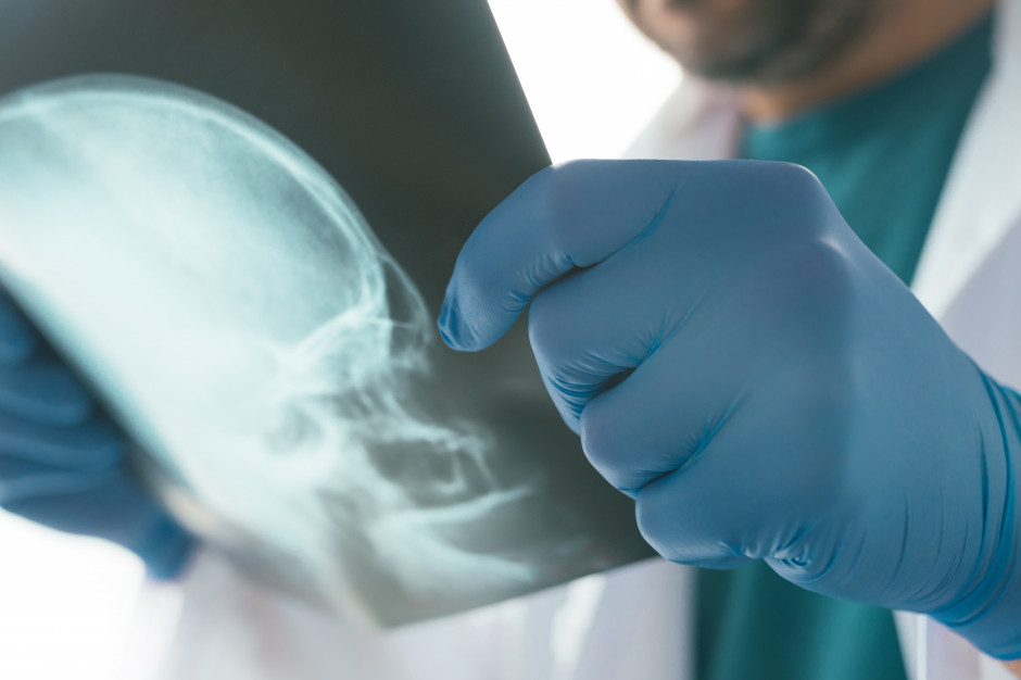 Lekarze z Olsztyna przeprowadzą trudną operację usunięcia guza z żuchwy Fot. Shutterstock