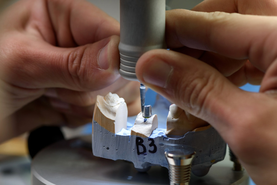 Proces tworzenia implantu zębowego przez technika dentystycznego Fot. Shutterstock