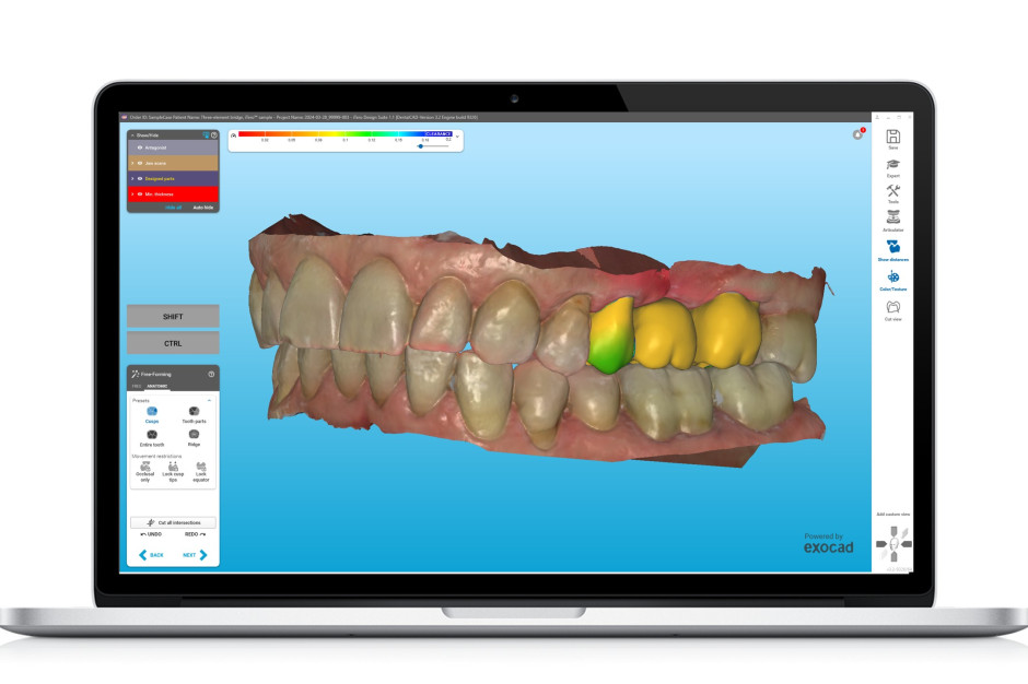 Innowacje w iTero™ Digital Solutions od Align Technology. Cyfrowy ...
