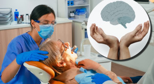 Stan jamy ustnej odkłada się w mózgu. Zapalenie dziąseł prowadzi do choroby Alzheimera?