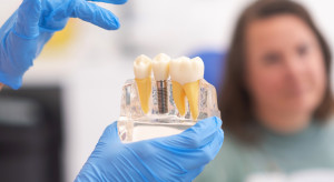 Implanty zębowe: biozgodne materiały i szybsza odbudowa uśmiechu