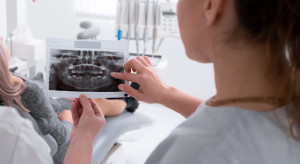 Zwichnięty ząb. Co decyduje o skutecznym ratunku